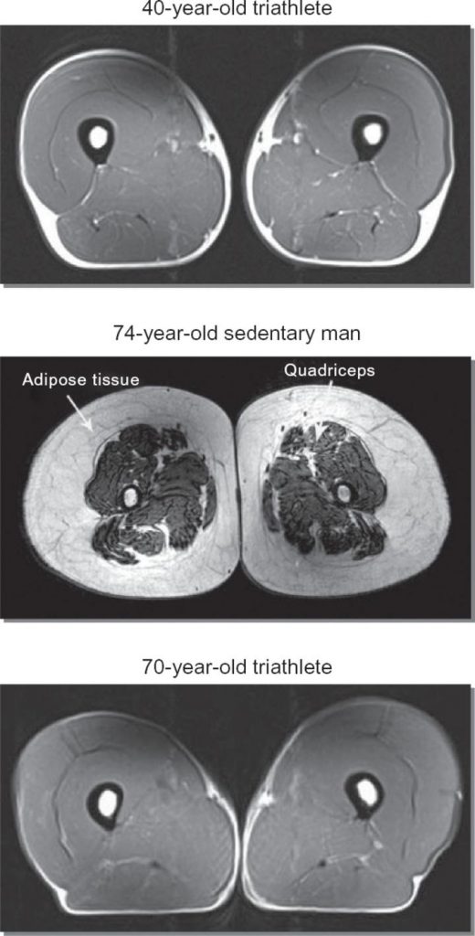 triathlete-vs-sedentary